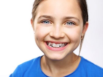 Ortodoncia para niños 
