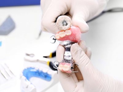 Prótesis dental 